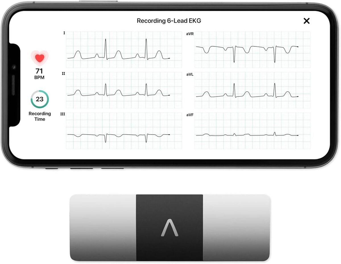 Test du AliveCor KardiaMobile 6L : le moniteur ECG portable ultrarapide